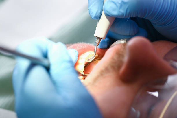 Best Emergency Dental Care for Trauma or Injury in Corrigan, TX