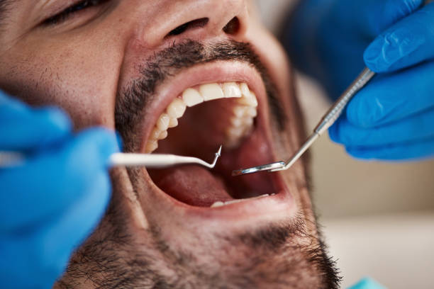 Best 24-Hour Emergency Dentist in Corrigan, TX