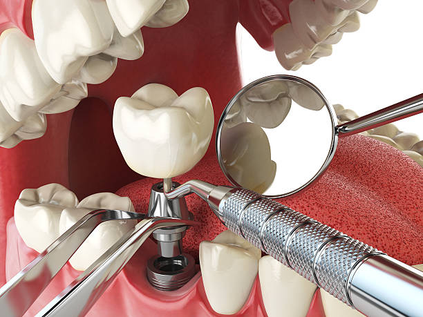 Best Emergency Dental Surgery in Corrigan, TX